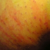 Apfel mit Wespenloch